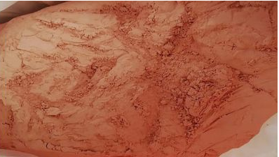 鈦石膏生產超硫酸鹽水泥,鈦石膏立磨